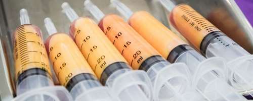 Wat is lipofilling?